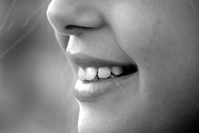 Mengapa Kita Harus Rajin Memeriksakan Gigi ke Dokter Gigi?