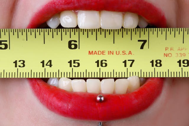 Hal Yang Diperhatikan Dalam Pasang Gigi Palsu Bogor
