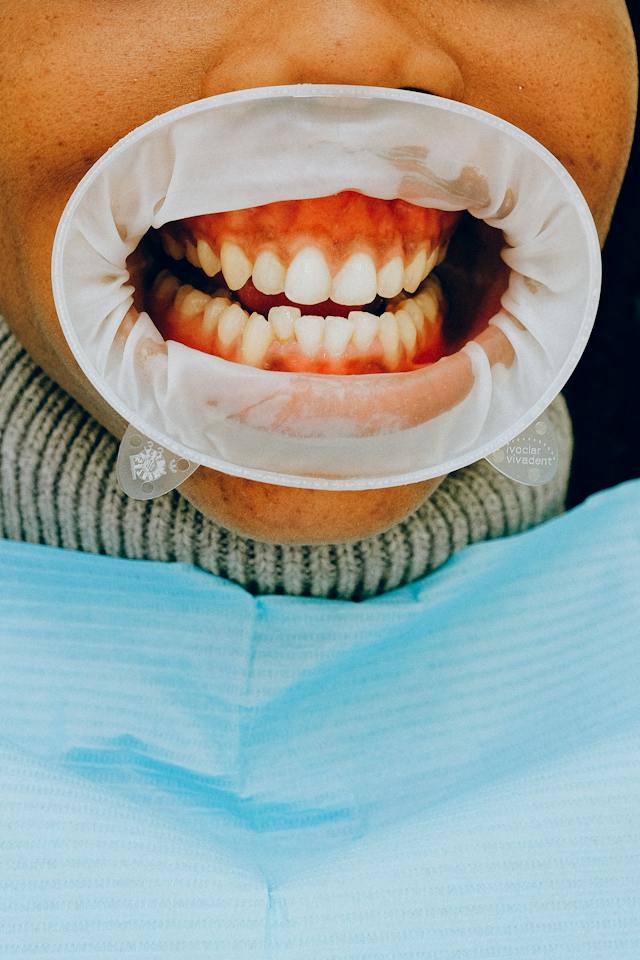 Mengatasi Ketakutan Saat Akan Pergi Ke Klinik Gigi Jakarta Pusat
